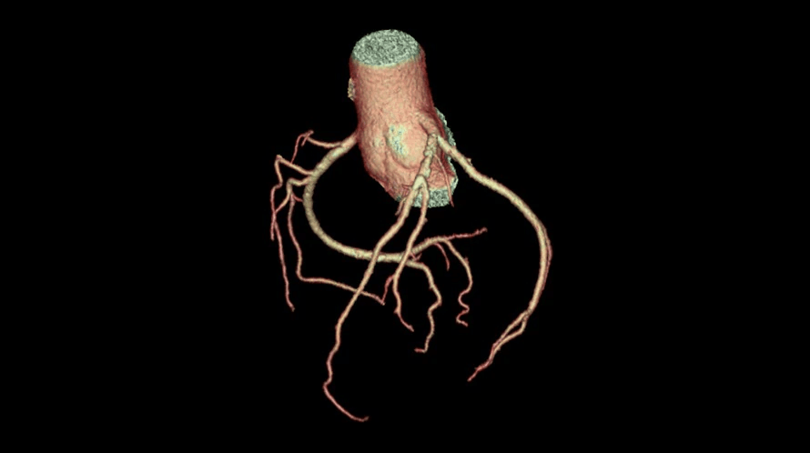 A computer-generated image of a heart with roots on a black background.