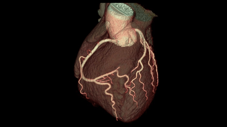 A computer-generated image of a heart with roots on a black background.