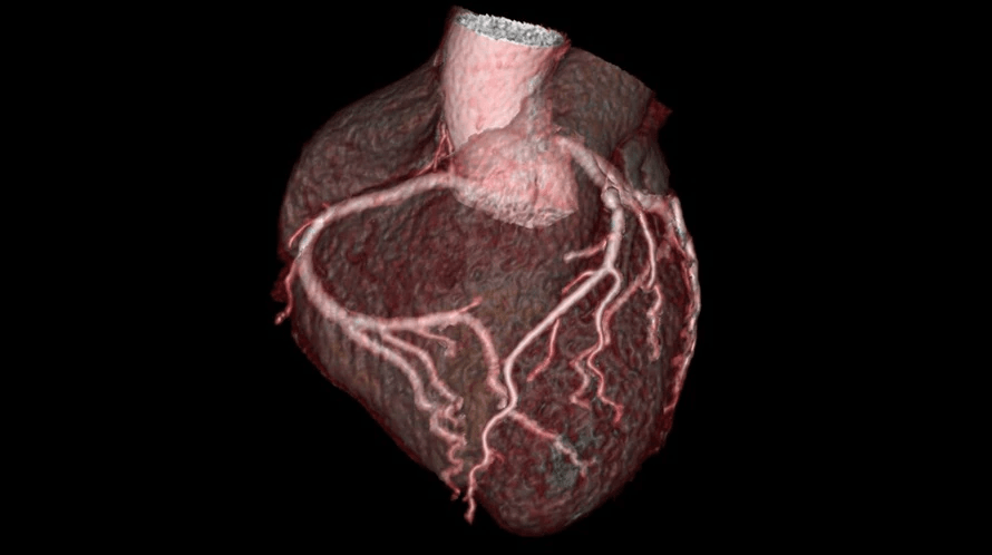 A computer-generated image of a heart with roots on a black background.