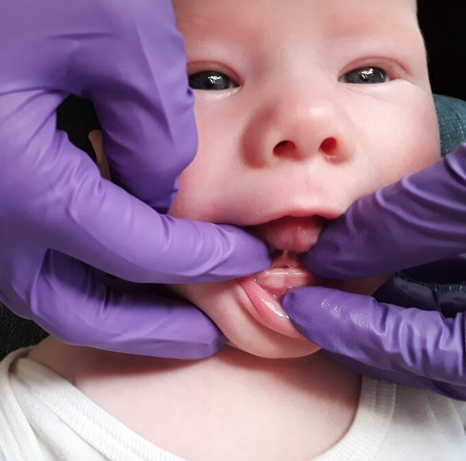 Close-up of a human ear with a small, round purple stud earring.