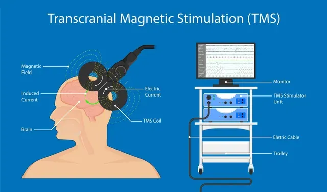 What are the side effects of TMS