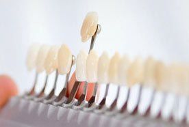A row of tooth-coloured crowns