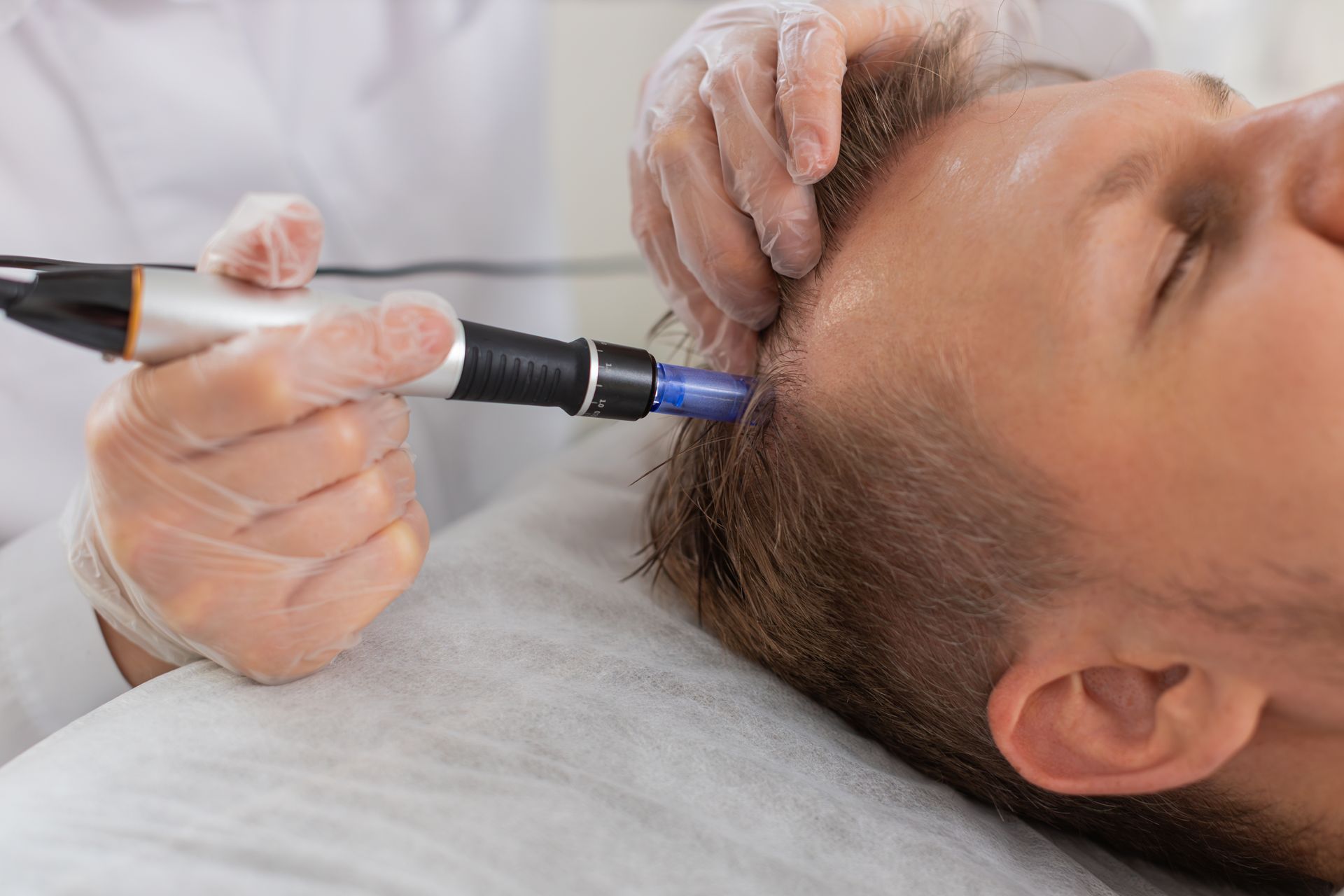 A man is getting a hair treatment in his head.