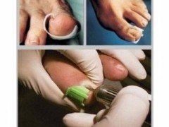 tecnica di fresatura all'avanguardia