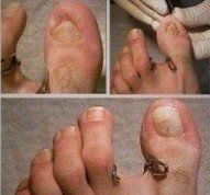 cura dell'unghia professionale