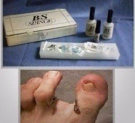 metodo per la cura delle unghie