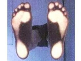 esame professionale della postura