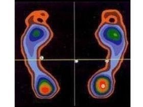 esame accurato della postura