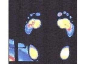 controllo con baropodometro elettronico