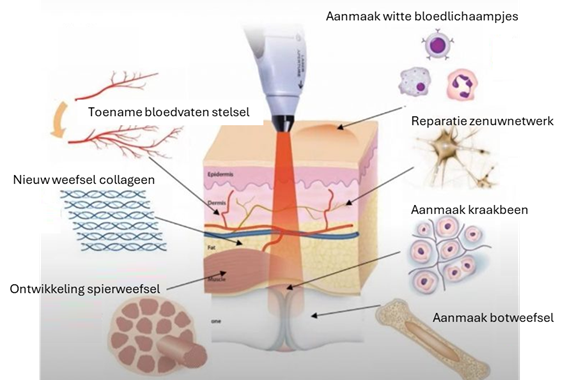 Schema weergave fotobiomodulatie effectieve gebieden