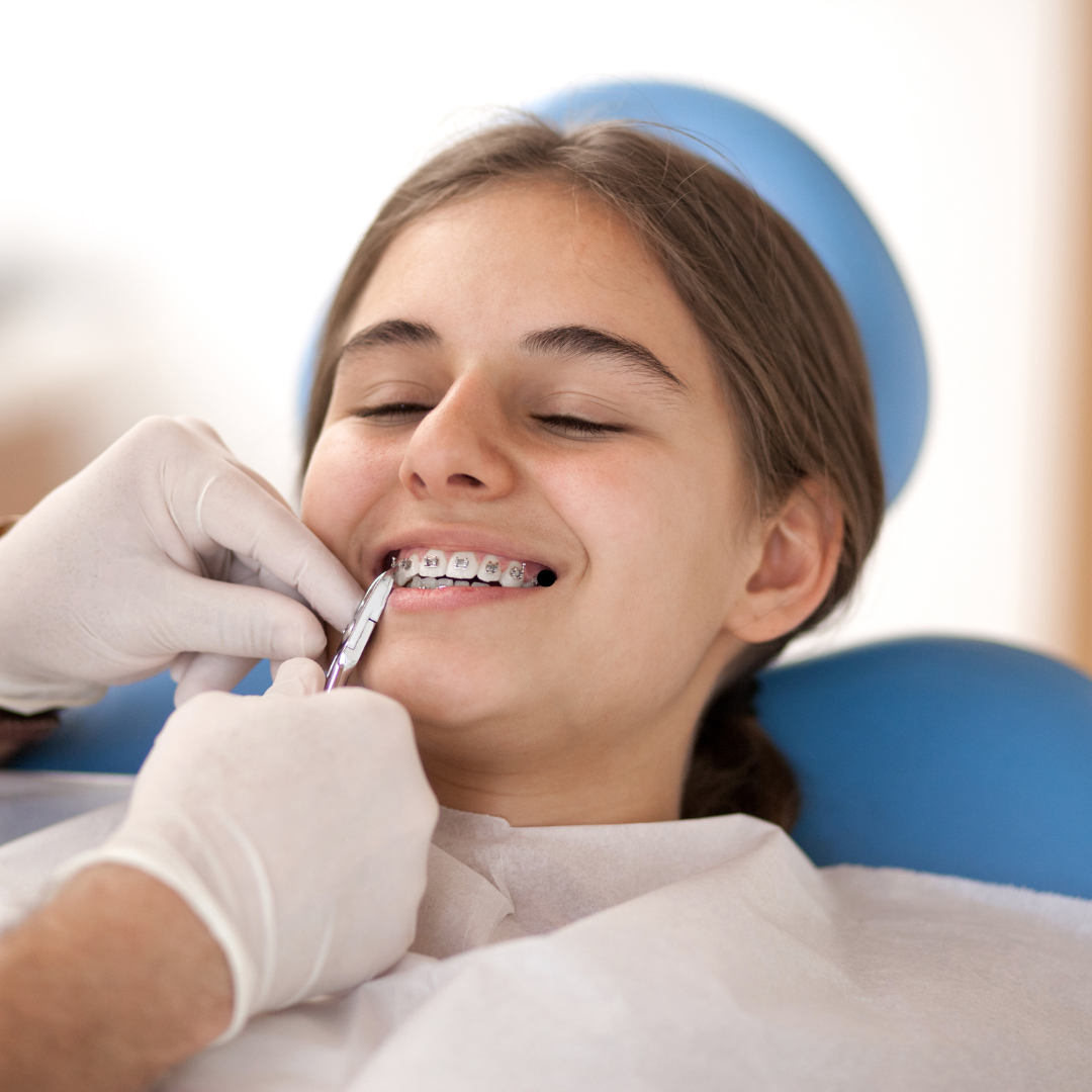 placing braces