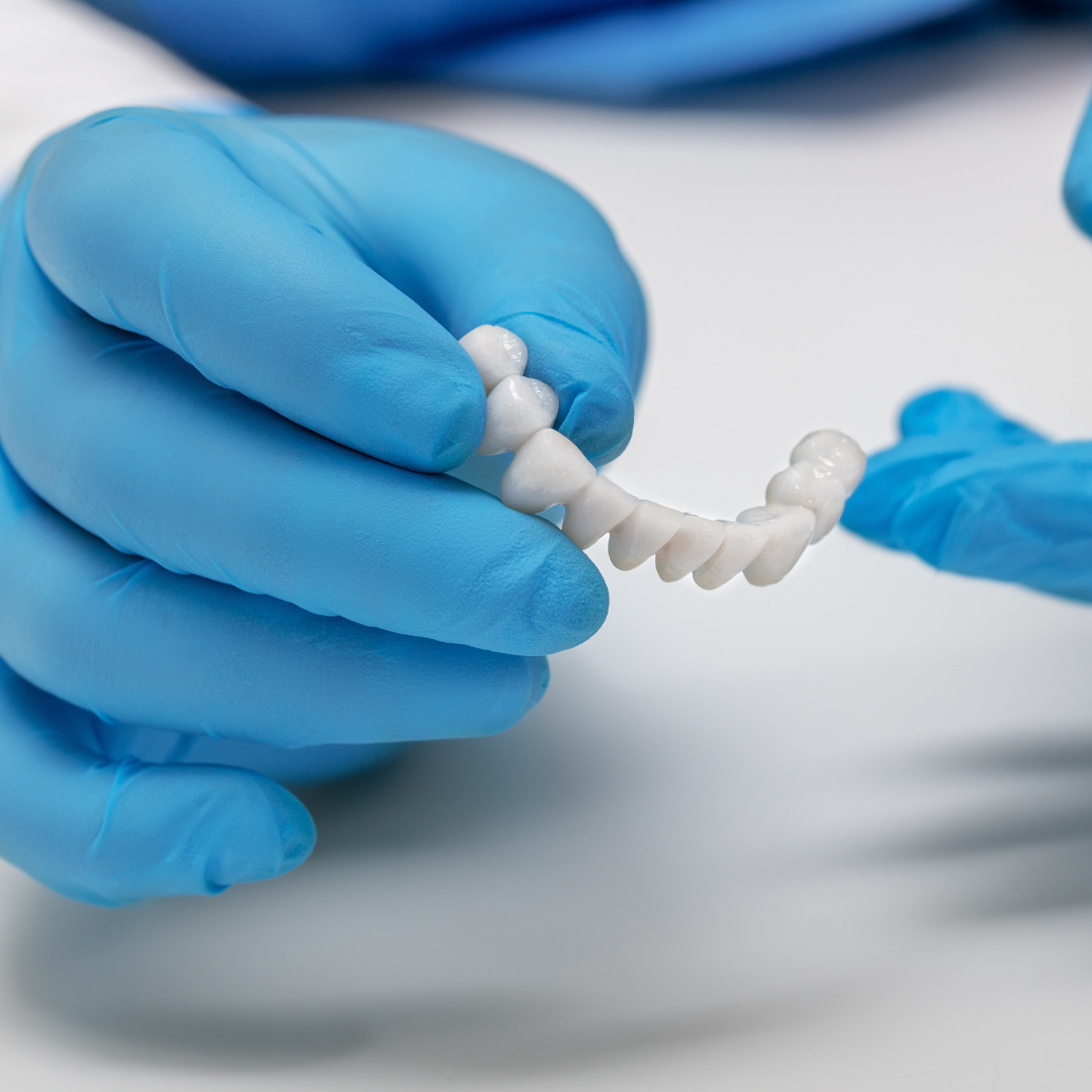 a dental bridge example