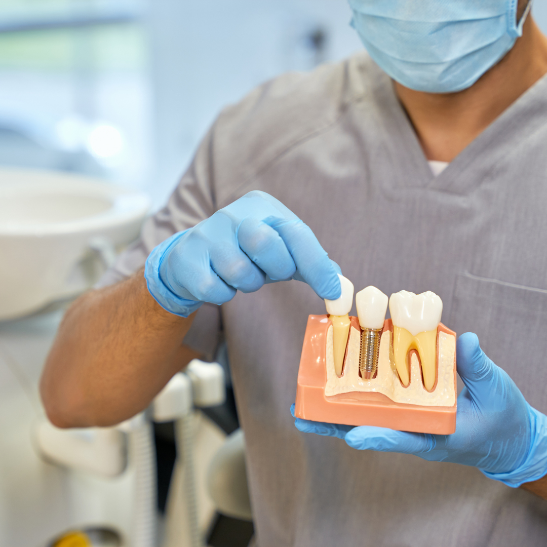 Dental Implants example