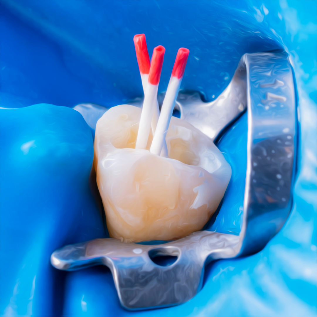root canal procedure