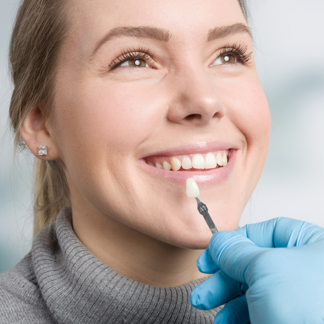 a woman testing veneers color