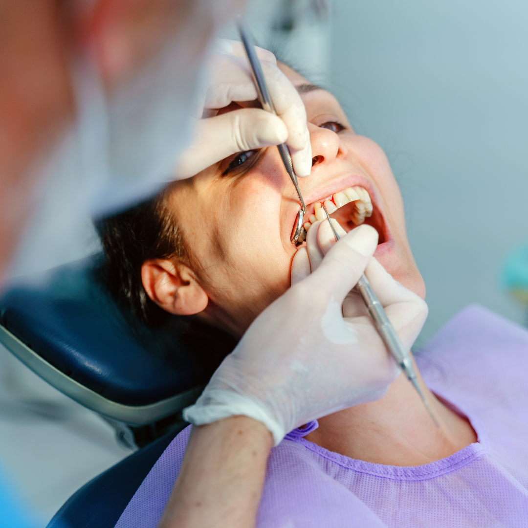 oral cancer screening