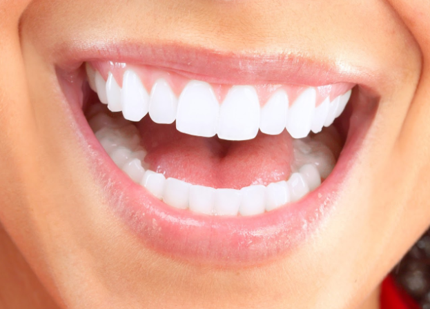 Braces and Teeth Whitening — Fresno, CA — Donald E. Snyder Orthodontics