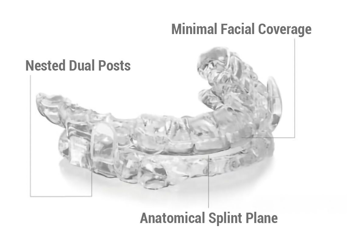 CPAP Alternative Oral Appliances