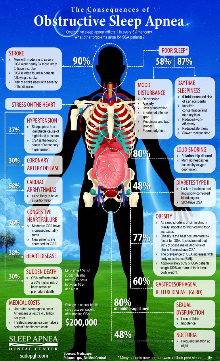 Obstructive Sleep Apnea Symptoms