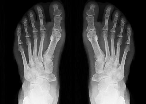 Healthy Feet — Milford, CT — Milford Footcare LLC