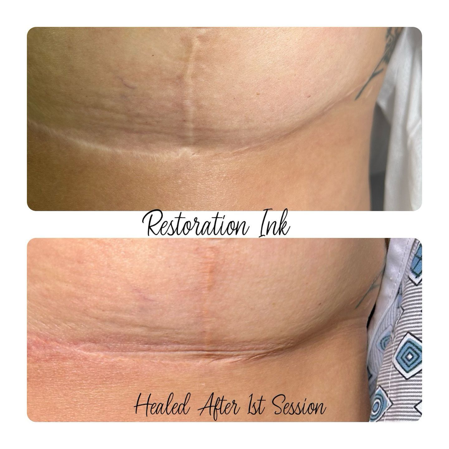 scar camouflage in NM