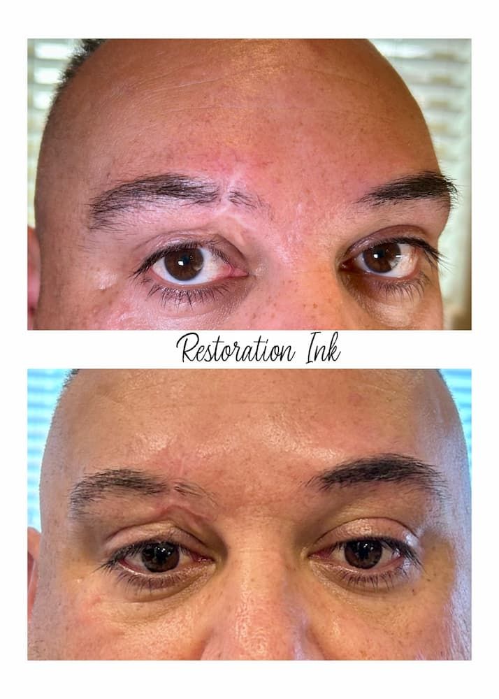 Before and after scar camouflage tattooing at Restoration Ink in New Mexico