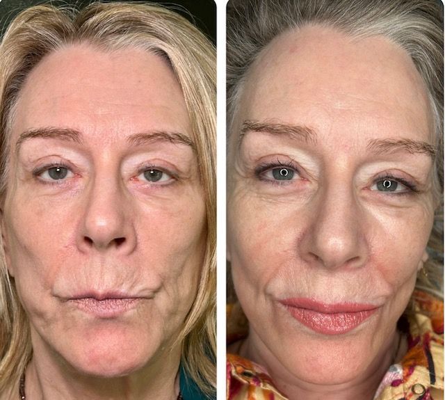 Lip blush enhancement in coral at Restoration Ink in Albuquerque, NM