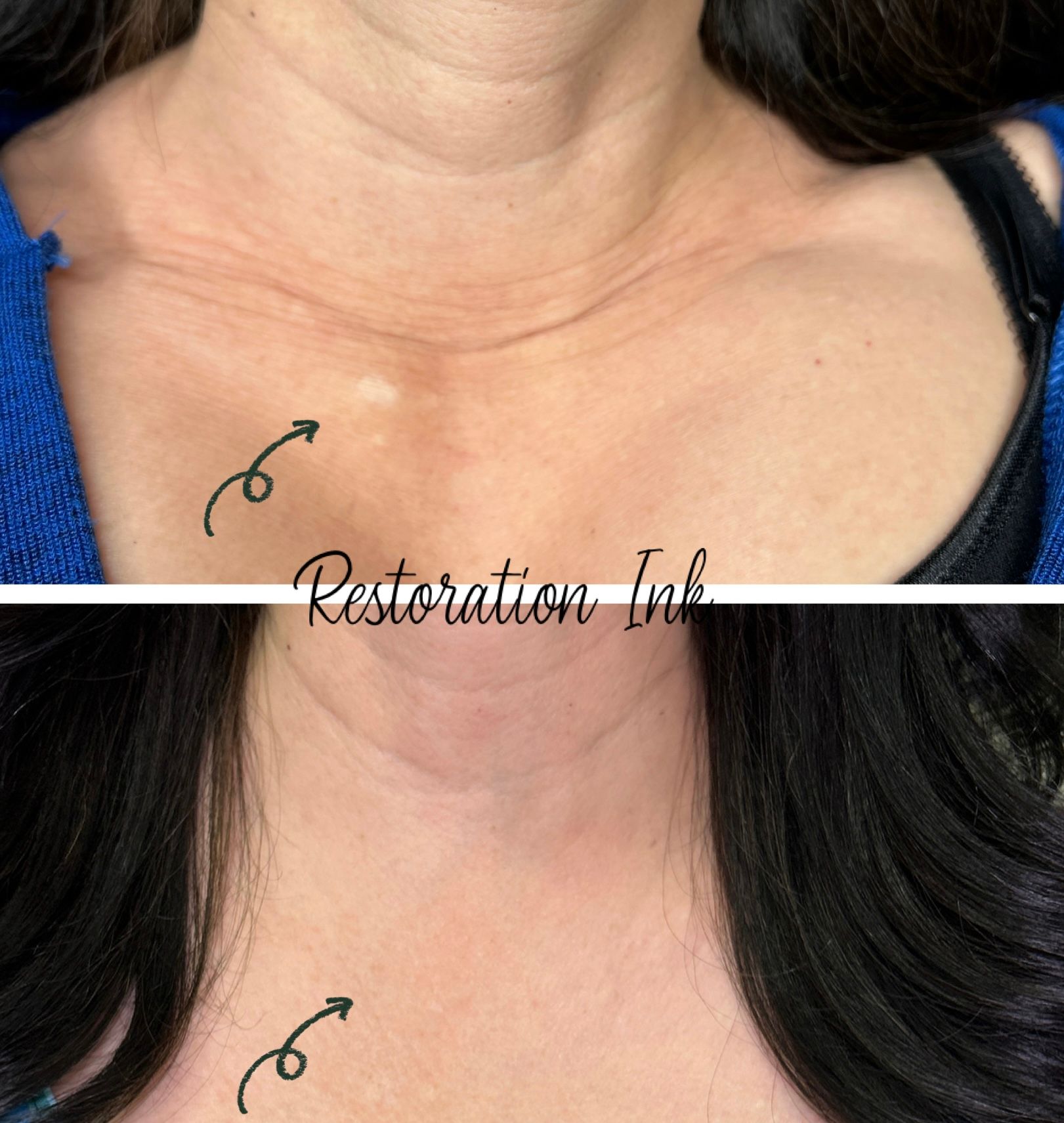 Scar camouflage tattoo at Restoration Ink in Albuquerque, NM.