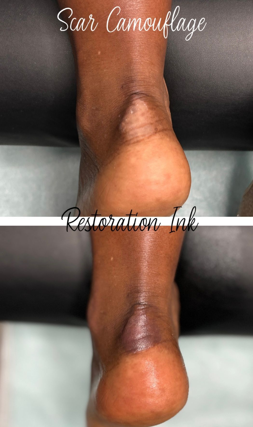 scar camouflage in Albuquerque 