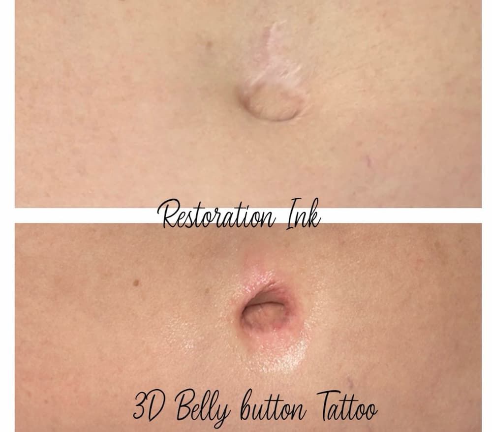 Scar camouflage tattooing before and after at Restoration Ink in Albuquerque, NM.
