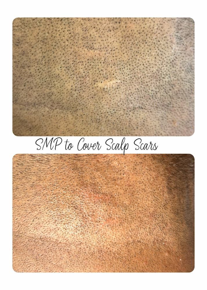 Before and after scalp micropigmentation at Restoration Ink in Albuquerque, NM