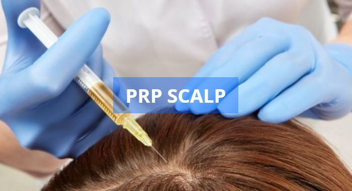 A person receiving a PRP (Platelet-Rich Plasma) scalp injection to stimulate hair growth. Doctor in blue gloves injects a needle into the scalp.