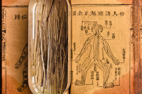 A book is open to a drawing of a human body
