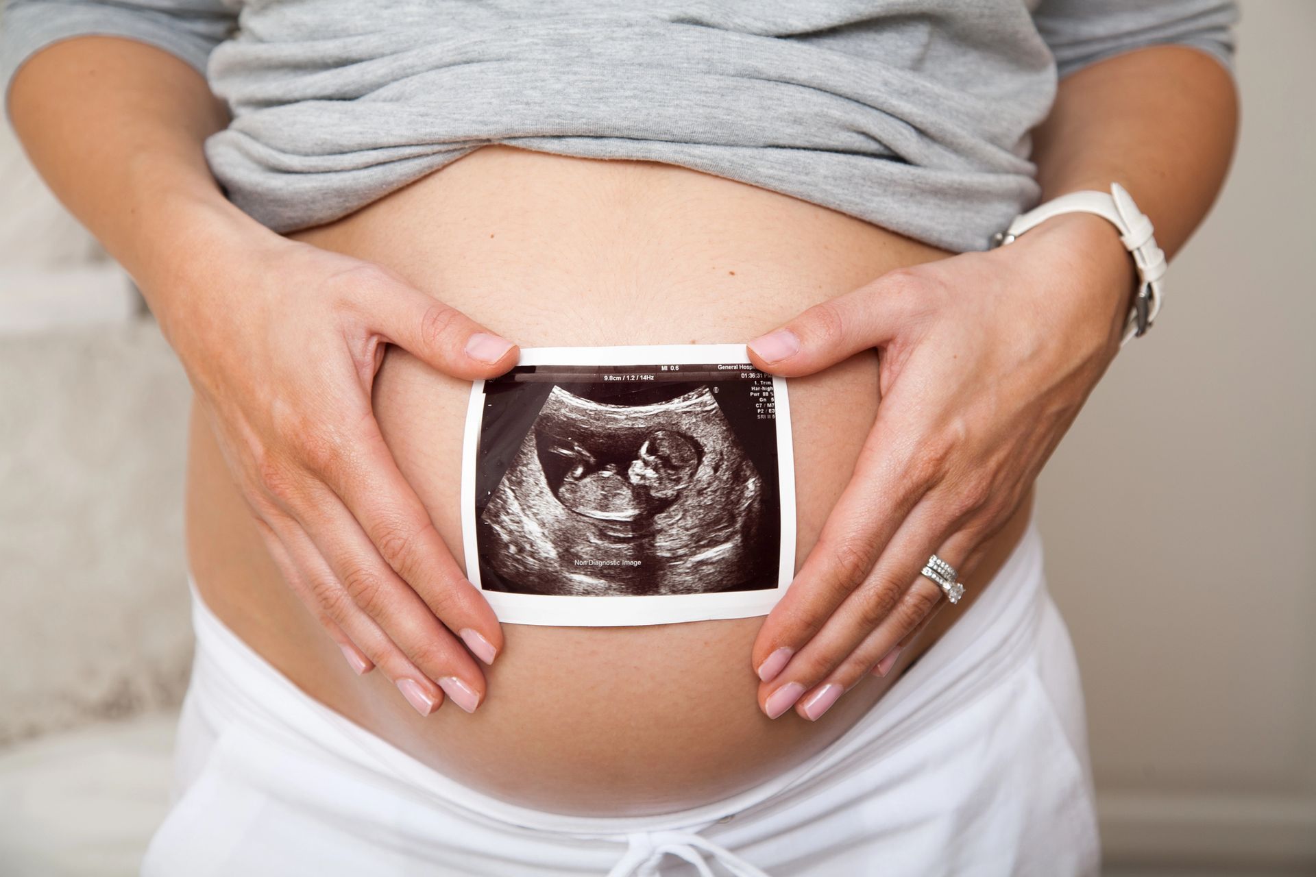 Pregnant person holding an ultrasound photo on their belly, hands forming a heart.