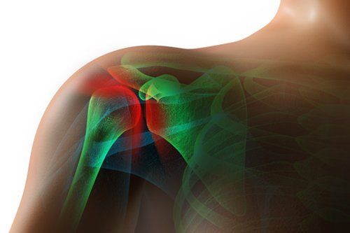 Shoulder X-Ray — Chattanooga, TN — Specialists In Pain Management