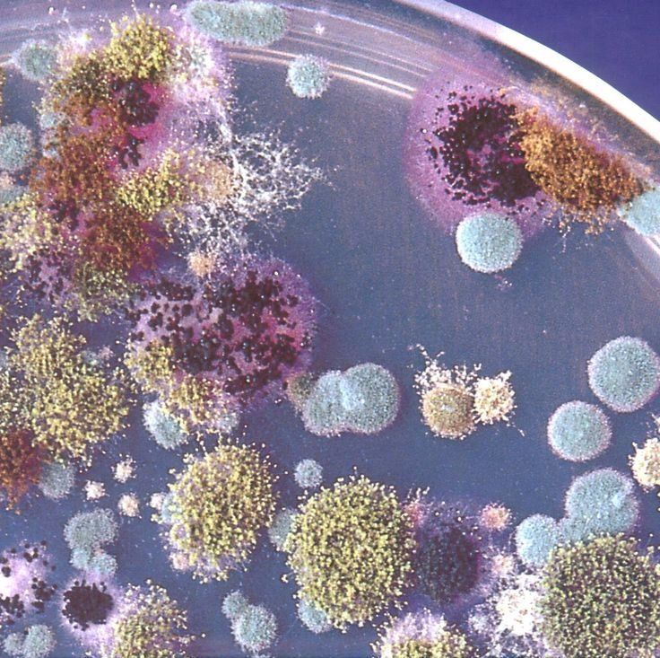 Image of a petri dish filled with biotoxins that can cause illness