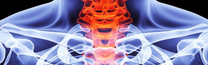 spinal discs near the shoulders and throat area | spine rehab for the Woodlands, TX