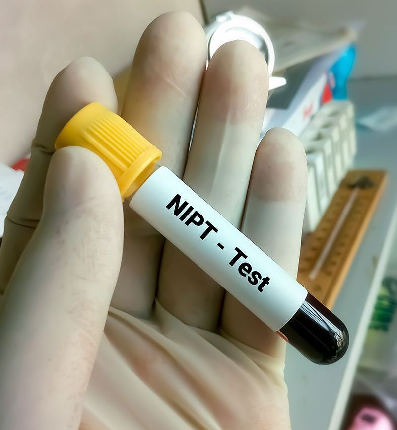 Person Holding NIPT Test Tube