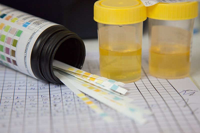 Urine Strip Test And Sample
