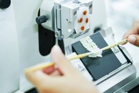 トップス kyanao miRNeasy FFPE Kit | FFPE Tissue microRNA Extraction | QIAGEN