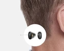 Primo piano dell'orecchio di una persona con un apparecchio acustico intrauricolare e una vista ingrandita del dispositivo.