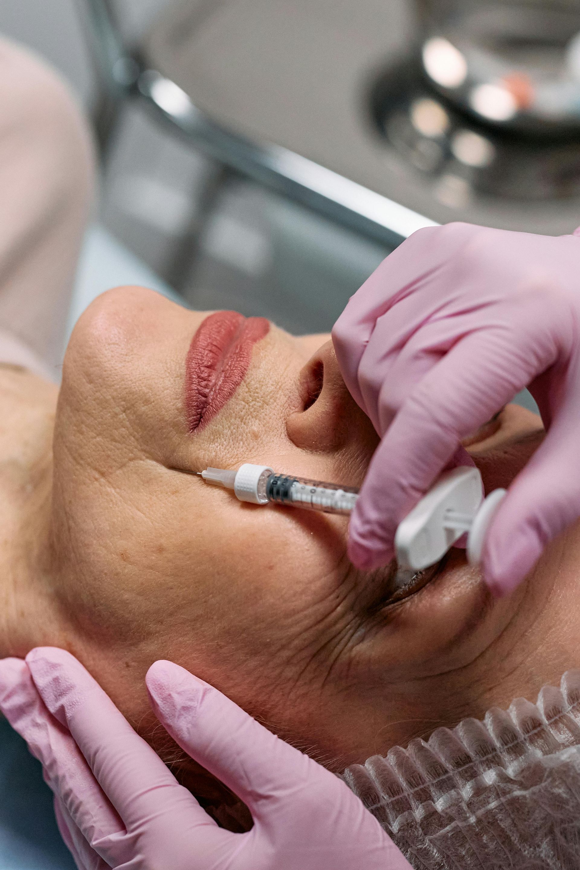 microneedling Anchorage