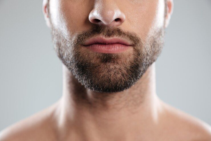Implante de barba em São Paulo