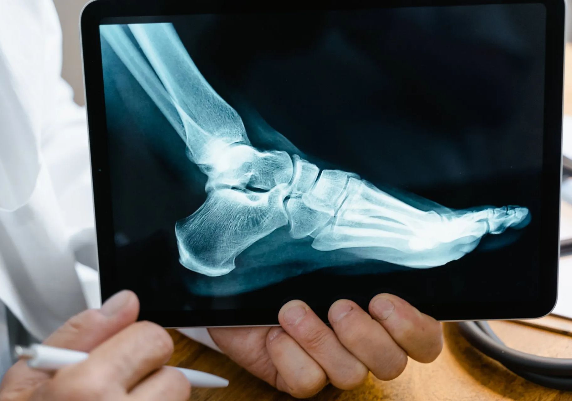 Doctor holding x-ray image at local podiatrist office
