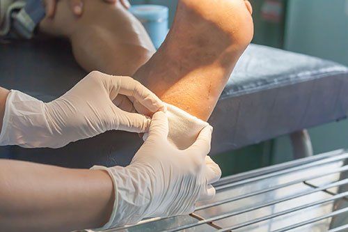 Diabetic foot ulcers getting treatment in a podiatrist office in North Tonawanda, NY