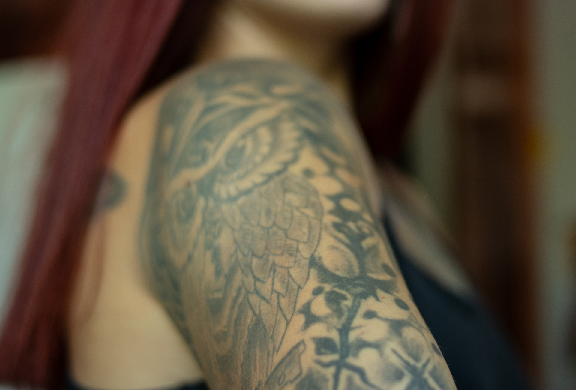 A gloved hand uses laser to remove a tattoo of a bird on skin.