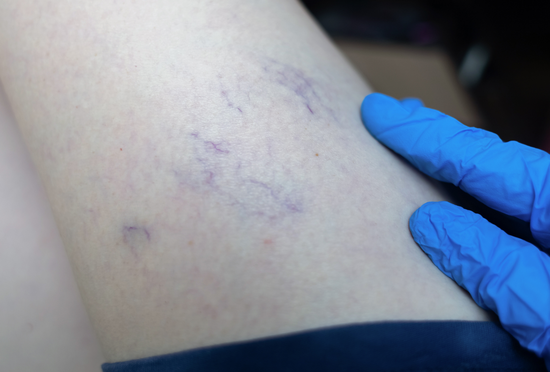 Man with gray hair and beard smiles directly at the camera.