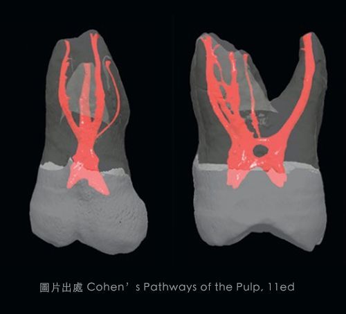 A cohen 's pathways of the pulp is shown on a black background