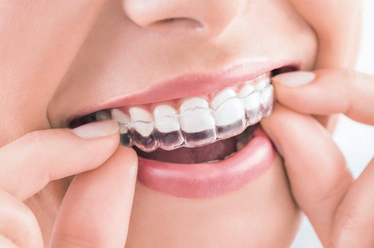 中山區牙醫診所牙齒矯正