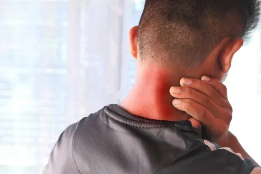 Person with red neck, touching it in pain. Indoor, near a window.
